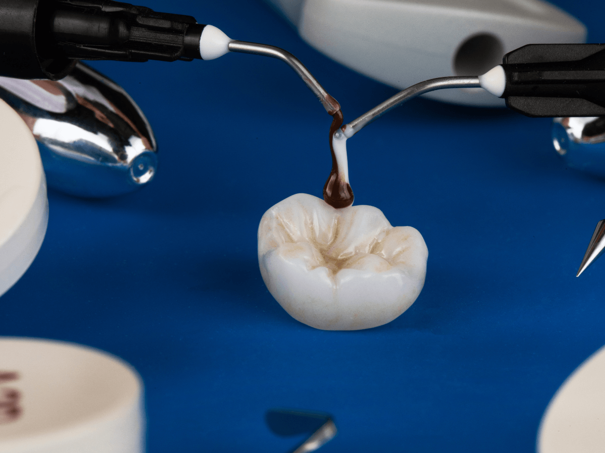 Inlays - Building A Career in Restorative Dentistry