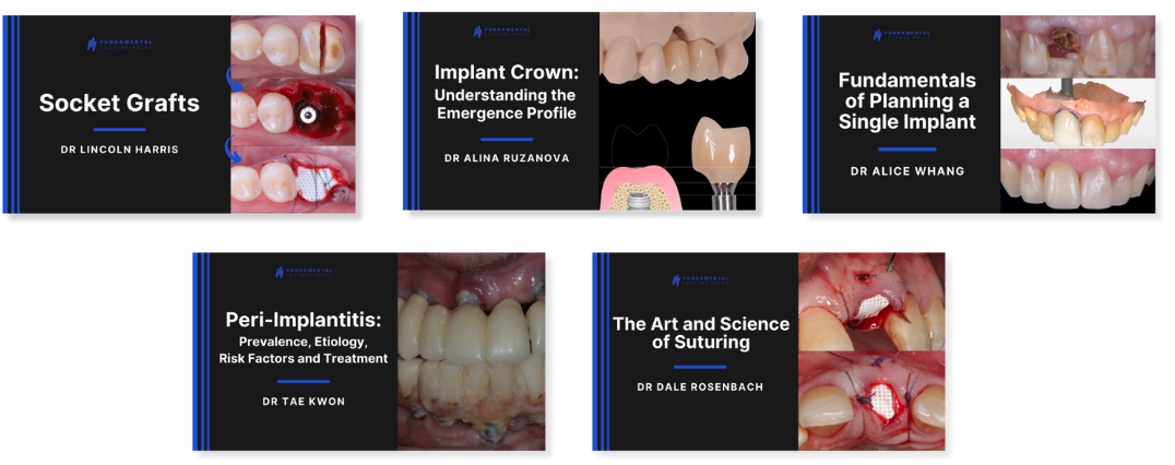 Implant Lecture Pack