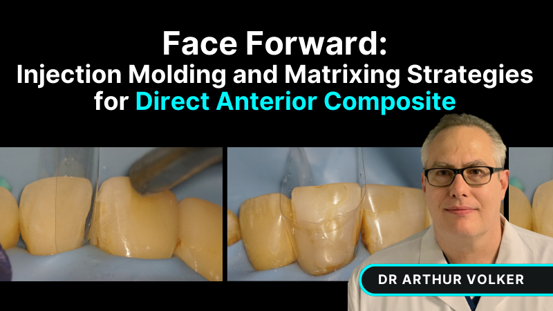 MKT-240611-Arthur Website Thumbnail Face Forward Direct Anterior Compsite 800