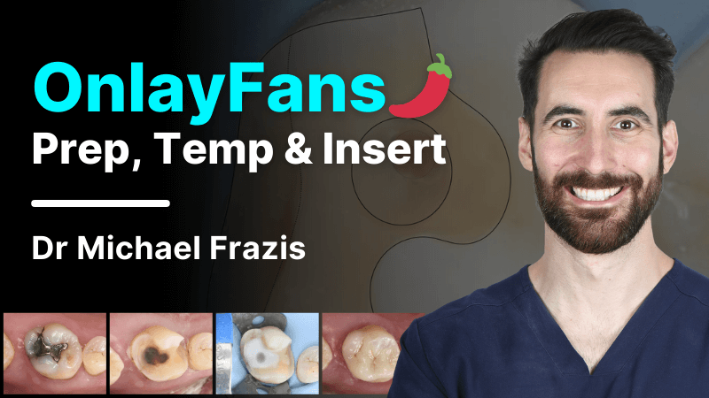 MKT-241213-Frazis Website Thumbnail OnlayFans Prep Temp and Insert (1)