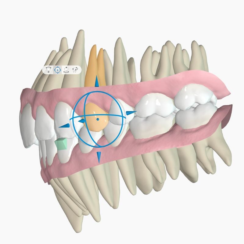 why how landing discipline Orthodontics 800